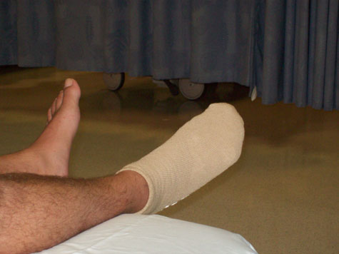 Here's my toe all wrapped up later that day. Now, more than two weeks later, I can say I'm getting back to normal ... which means it looks like I'll be mowing the lawn this weekend. Hoo-rah. (Photo by Kim Kovar)